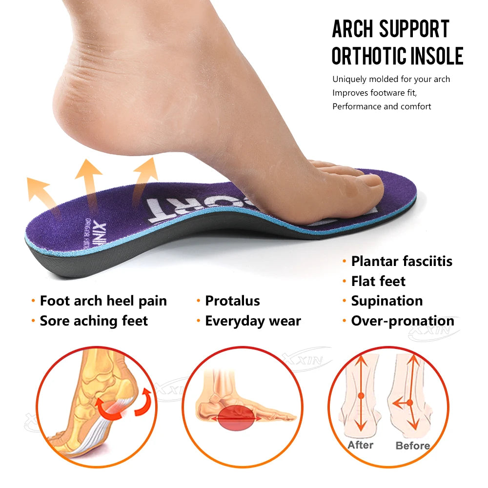 【Xxin】Arch Support Insoles Flat Foot Shoe Insoles Orthopedic Shoe Pad Women Men Sport Insole size 35-46